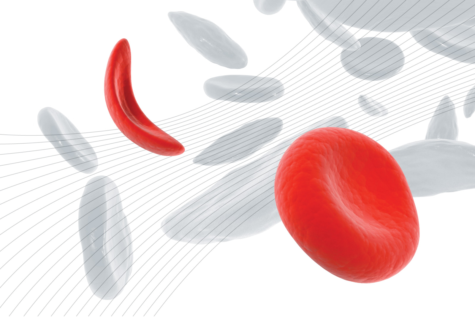 ARISE project launched to address Sickle Cell Disease challenges
