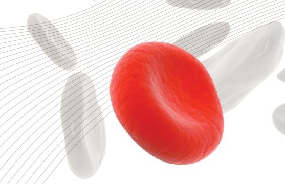 ARISE project meeting: advancing Sickle Cell Disease research